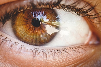 Cornea | Cornea Specialist Houston