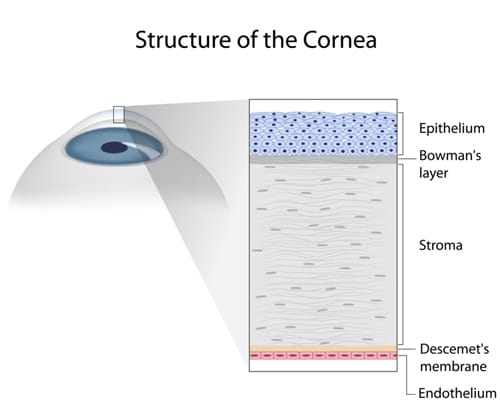 Recurrent erosion syndrome