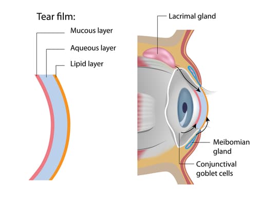 Meibomitis