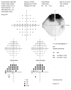 Visual Field