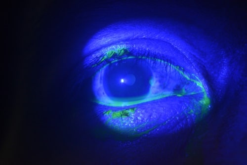 Close up of the cornea during eye exami