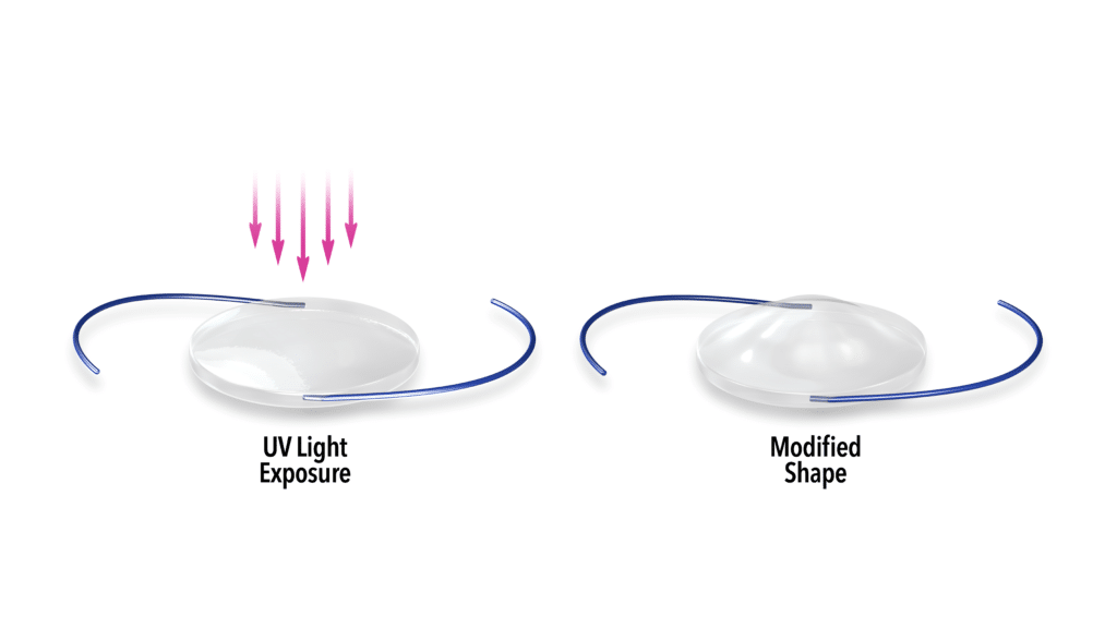 Light Adjustable Lens Illustration